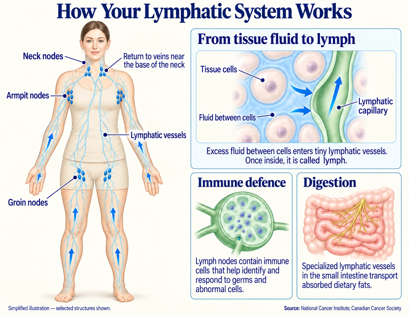 How your lymphatic system works. A body outline shows lymphatic vessels running up the arms, legs and trunk, with groups of lymph nodes at the neck, armpits and groin, and the return point to veins near the base of the neck. Inset: excess fluid between tissue cells enters tiny lymphatic capillaries, and once inside it is called lymph. Immune defence: lymph nodes contain immune cells that help identify and respond to germs and abnormal cells. Digestion: specialized lymphatic vessels in the small intestine transport absorbed dietary fats. Selected structures shown. Source: National Cancer Institute; Canadian Cancer Society.